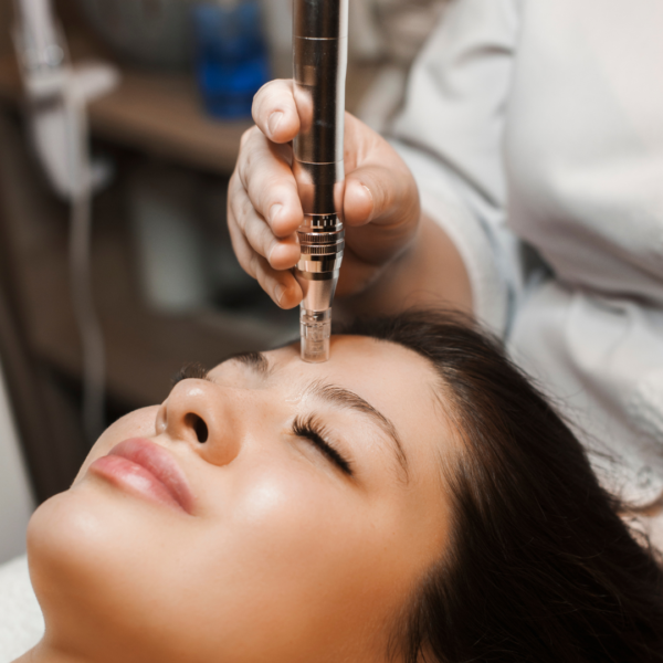 Tratamiento de Microneedling facial en Murcia para hidratación profunda y rejuvenecimiento con Dermapen.