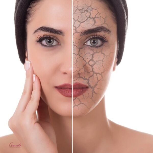 Skinbooster hidratación facial en Murcia