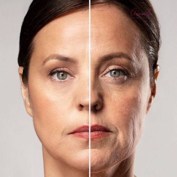 Tratamiento de armonización facial y bioestimulación de colágeno en Ananda Centro Médico Estetico